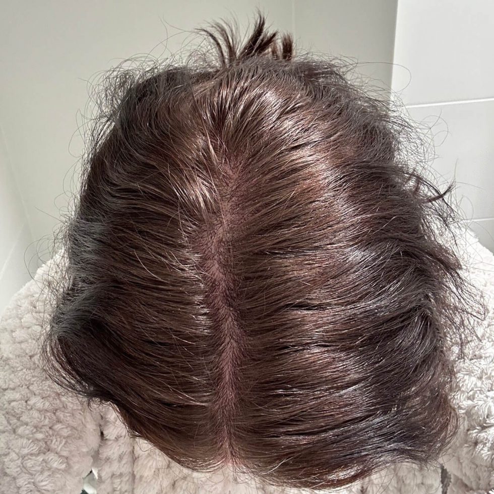 The Hairy Pill® Hair Loss Treatment for Men & Women