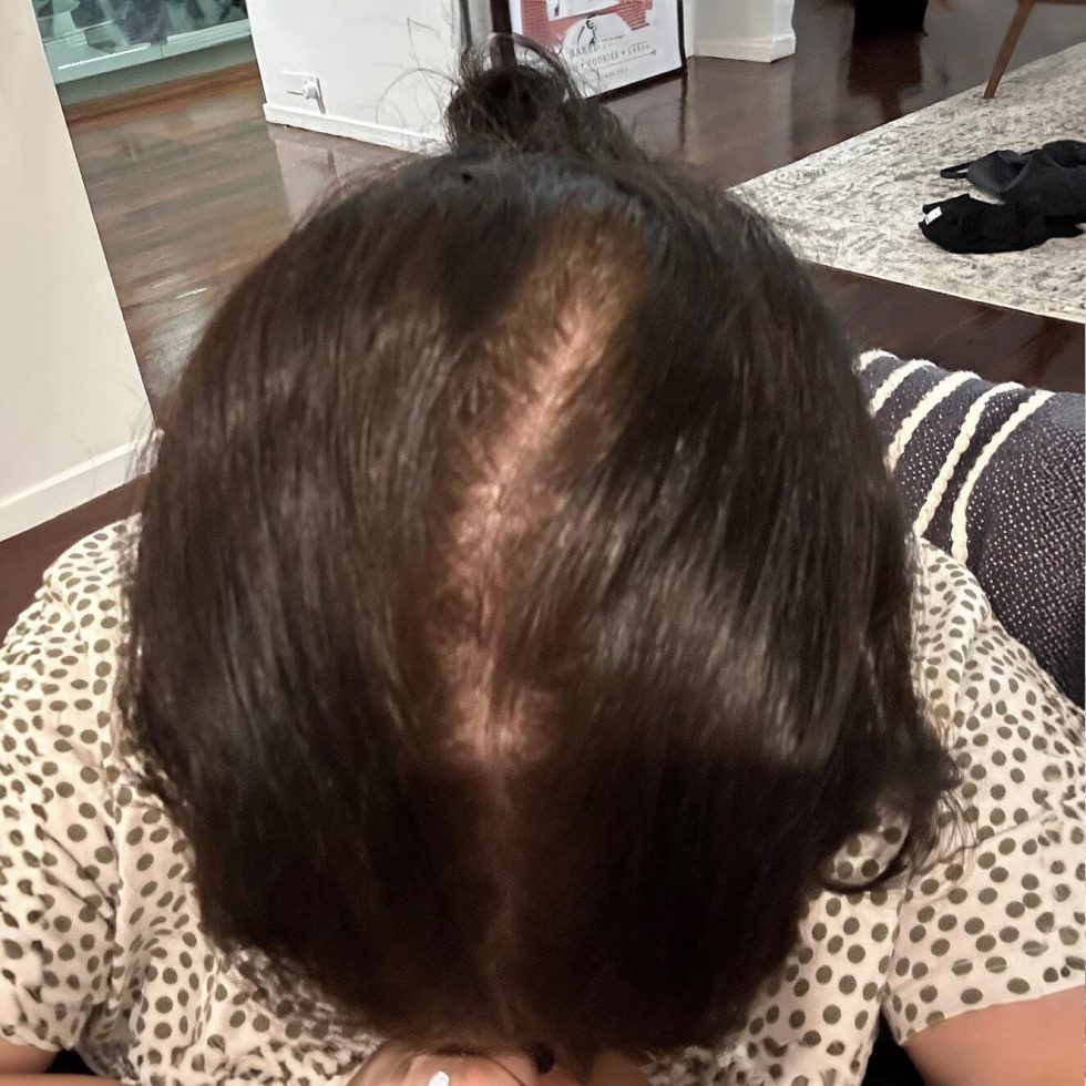 The Hairy Pill® Hair Loss Treatment for Men & Women