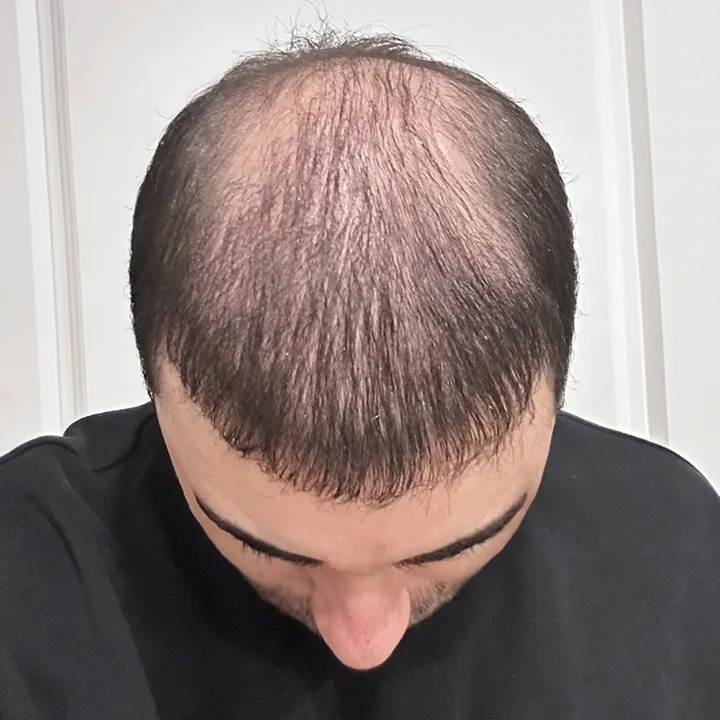 Before